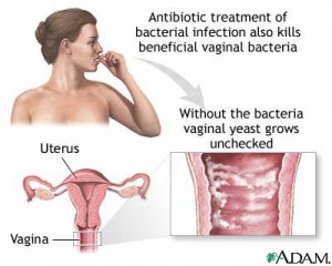 natural cures for yeast infections